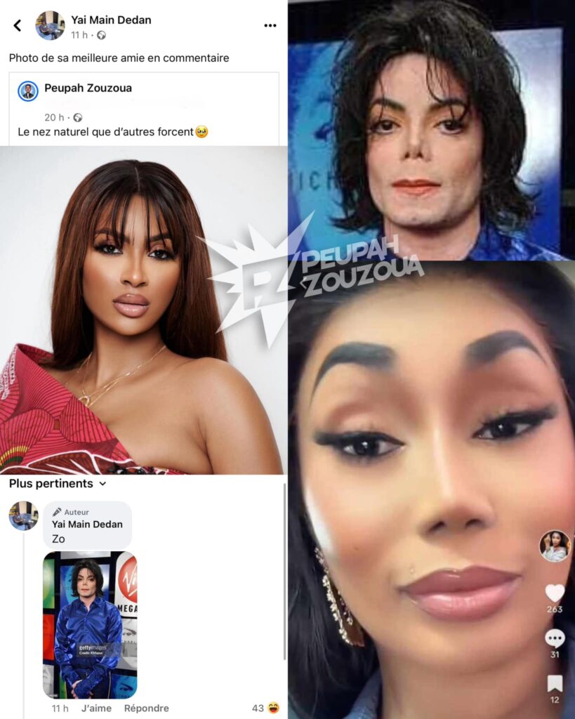 Emma Lohoues: Her Nose at the Center of a Heated Controversy on Social Media (Photo) 1 Emma Lohoues Nez 1 Emma Lohoues: Her Nose at the Center of a Heated Controversy on Social Media (Photo)