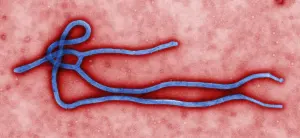 Ebola virus particle observed under an electron microscope