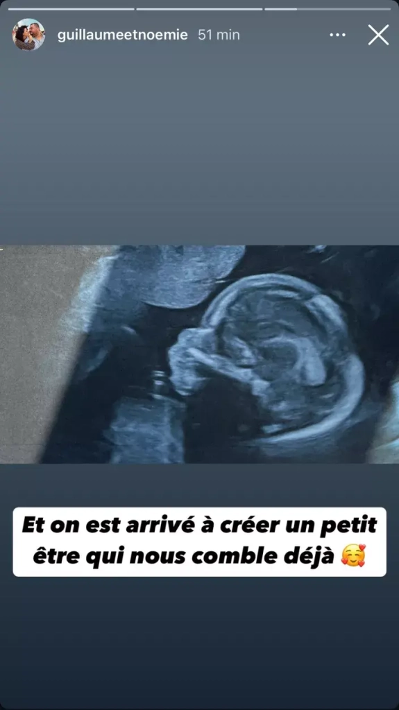 L’amour est dans le pré: un couple emblématique attend leur premier enfant 1 image L’amour est dans le pré: un couple emblématique attend leur premier enfant
