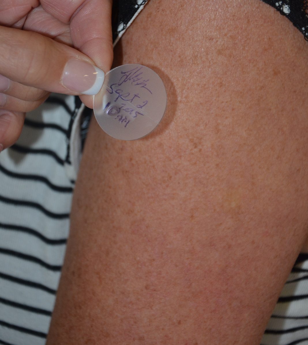 Patch transdermique appliqué sur la peau