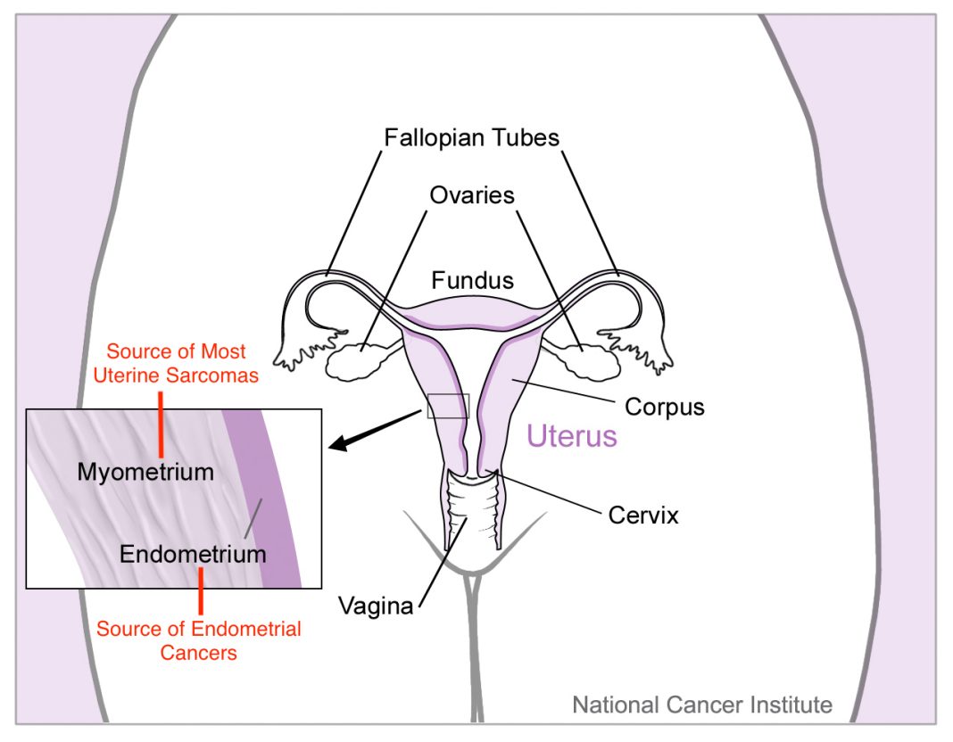 Schéma anatomique de l’utérus et des tissus où peuvent apparaître des cancers